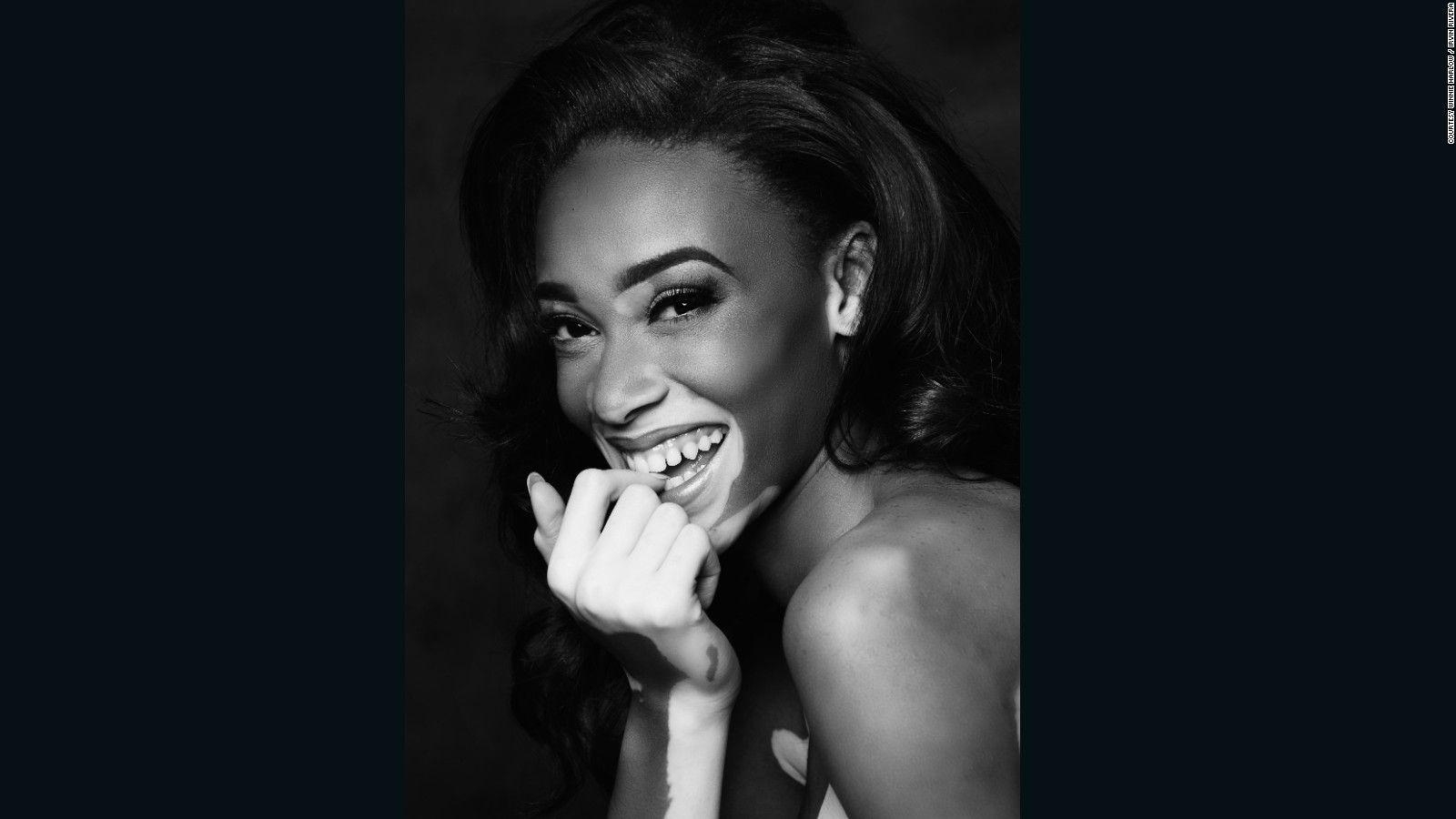 1600x900 Winnie Harlow's changing the face of fashion, Desktop