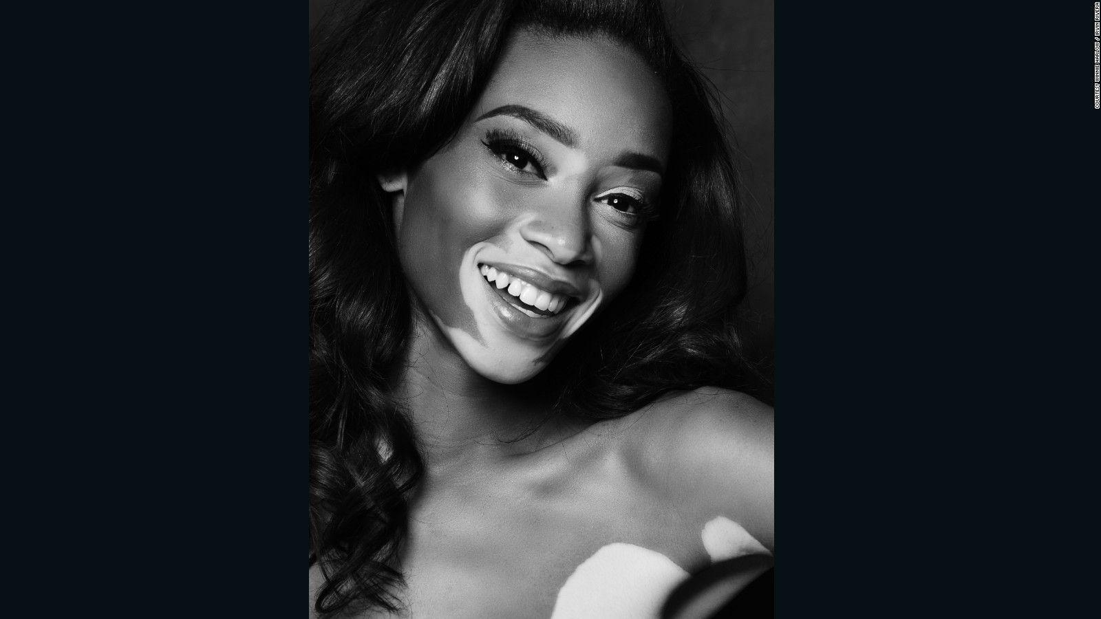 1600x900 Model Winnie Harlow is changing the face of fashion Style, Desktop