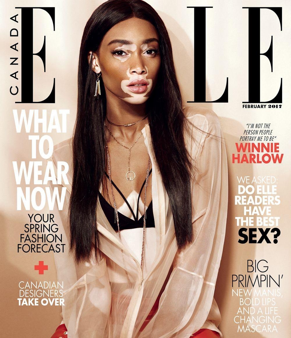 1000x1170 ELLE Canada February 2017 Winnie Harlow by Nelson Simoneau. Winnie, Phone