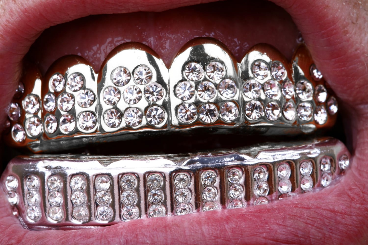 1500x1000 TYPES OF GRILLZ: WHAT ARE THEIR DIFFERENCES? Gold Grillz, Desktop