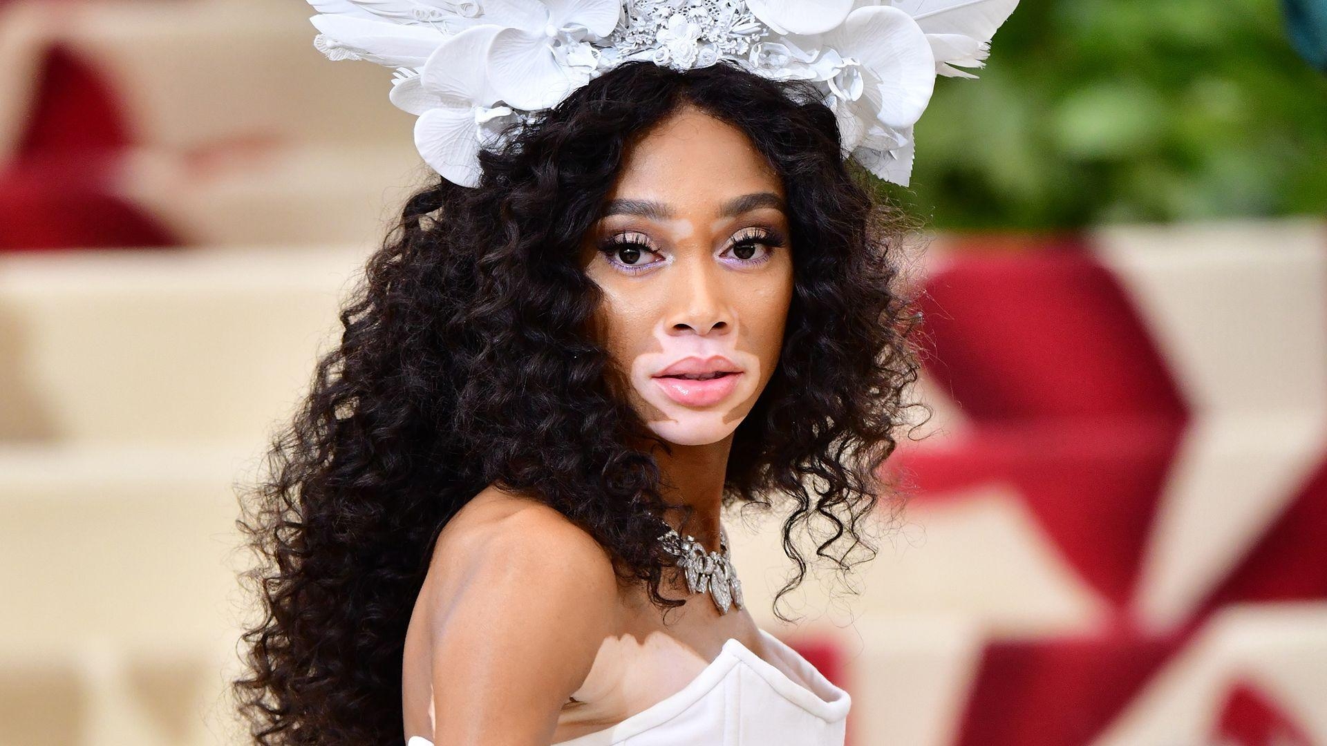 1920x1080 Winnie Harlow Disses 'America's Next Top Model', Desktop