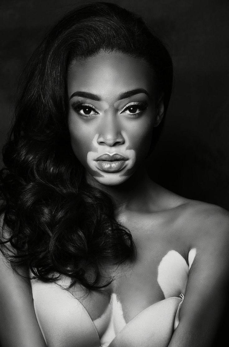 740x1120 best Winnie Harlow image. Winnie harlow, Phone