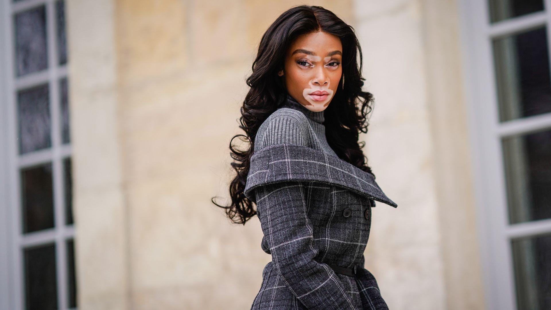 1920x1080 Winnie Harlow Slams Magazine for Vitiligo Comment, Desktop