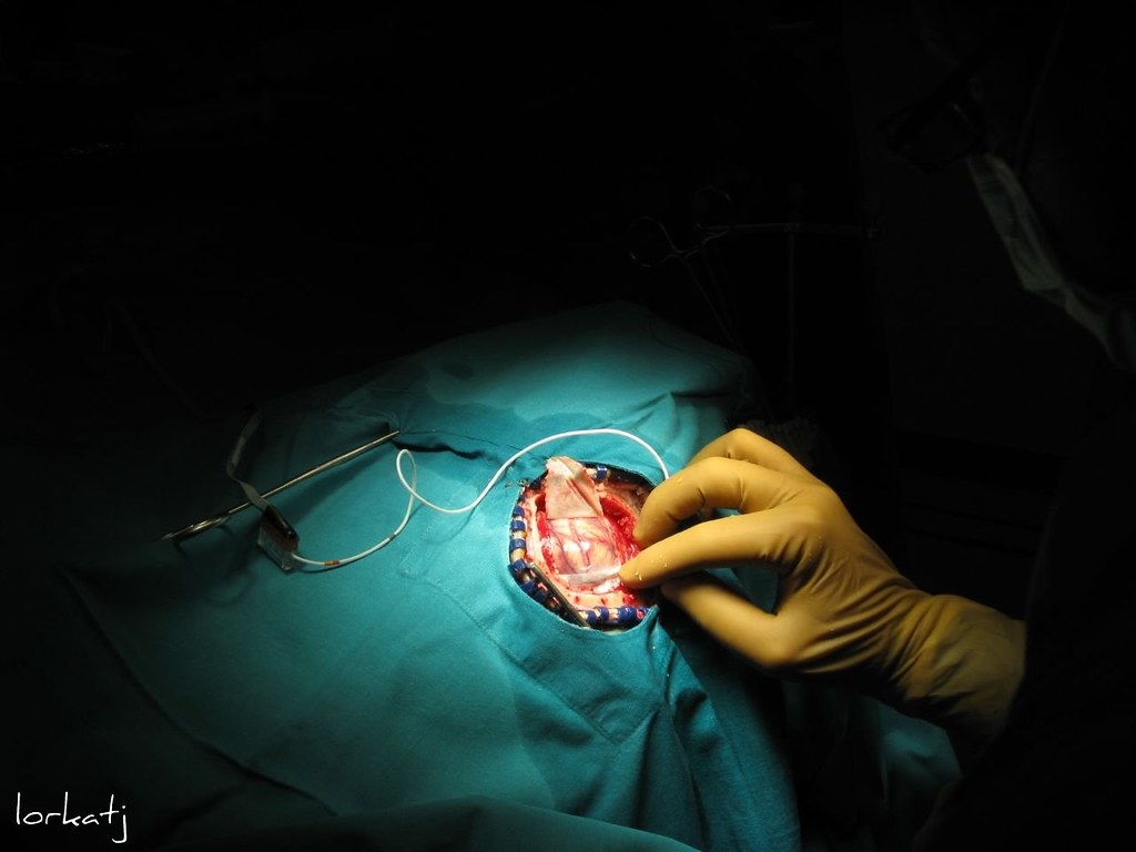 1030x770 neurosurgery, Desktop