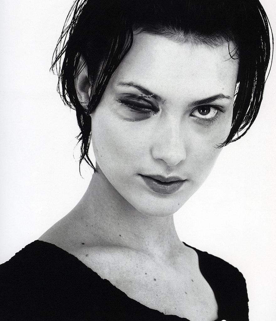 880x1030 Shalom Harlow Black Eye, Phone